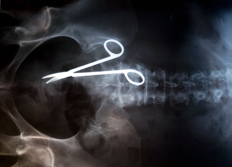 Illustration for article titled The Extraordinary Evolution of Scissors